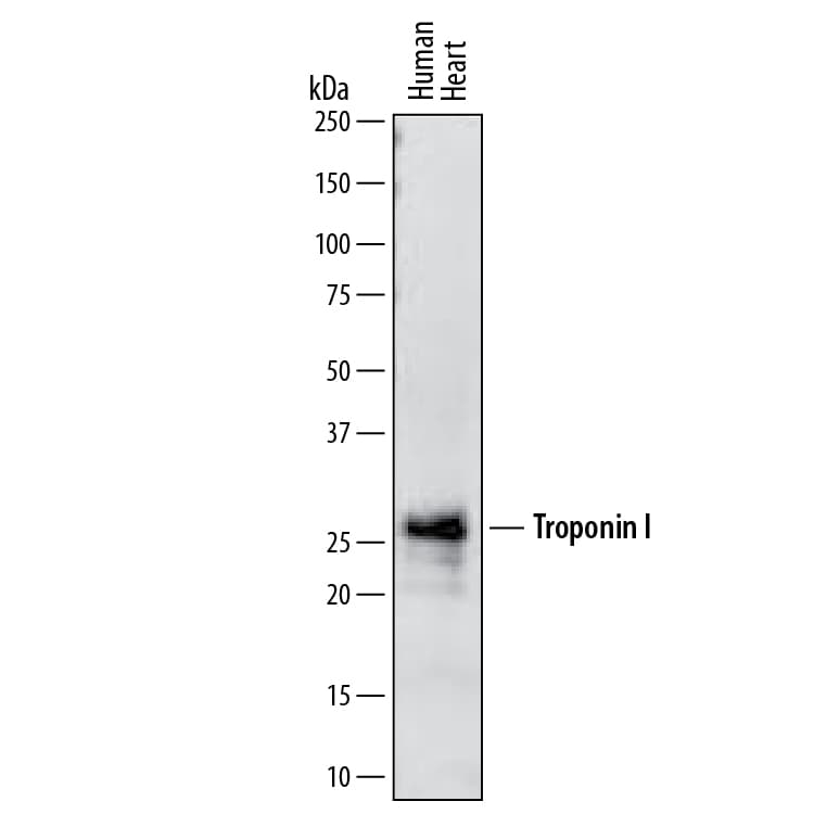Detection of Human Troponin I antibody by Western Blot.