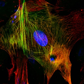 Troponin I antibody in Human Cardiomyocytes by Immunocytochemistry (ICC).