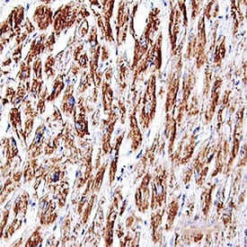 Troponin T antibody in Human Heart by Immunohistochemistry (IHC-P).