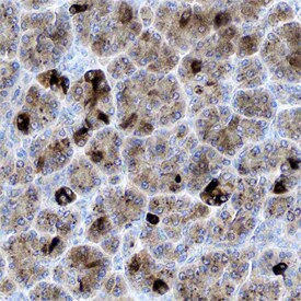 Tryptase e/BSSP-4 antibody in Human Pancreas by Immunohistochemistry (IHC-P).