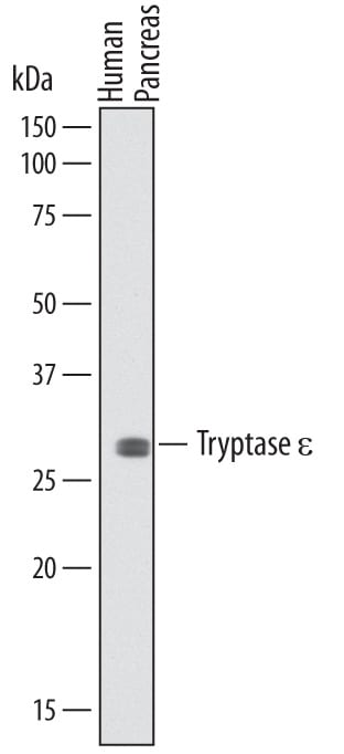 Detection of Human Tryptase e/BSSP-4 antibody by Western Blot.