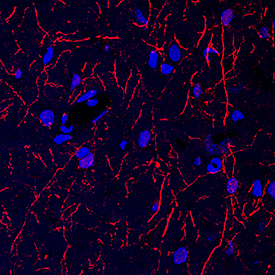 Tryptophan Hydroxylase 1/TPH-1 antibody in Rat Brain by Immunohistochemistry (IHC-Fr).