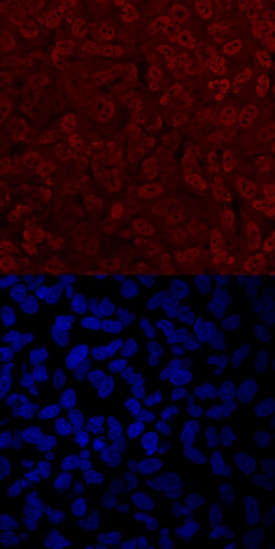 Twist-2 antibody in A549 Human Cell Line by Immunocytochemistry (ICC).