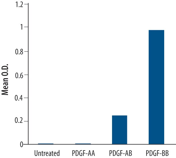 Detection of Phospho-Tyrosine antibody by Western Blot.