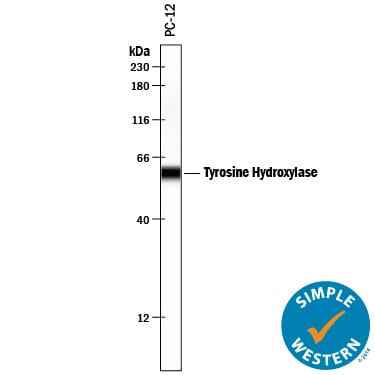 Detection of Rat Tyrosine Hydroxylase antibody by Simple WesternTM.