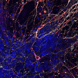 Tyrosine Hydroxylase antibody in Mouse Dopaminergic Neurons by Immunocytochemistry (ICC).