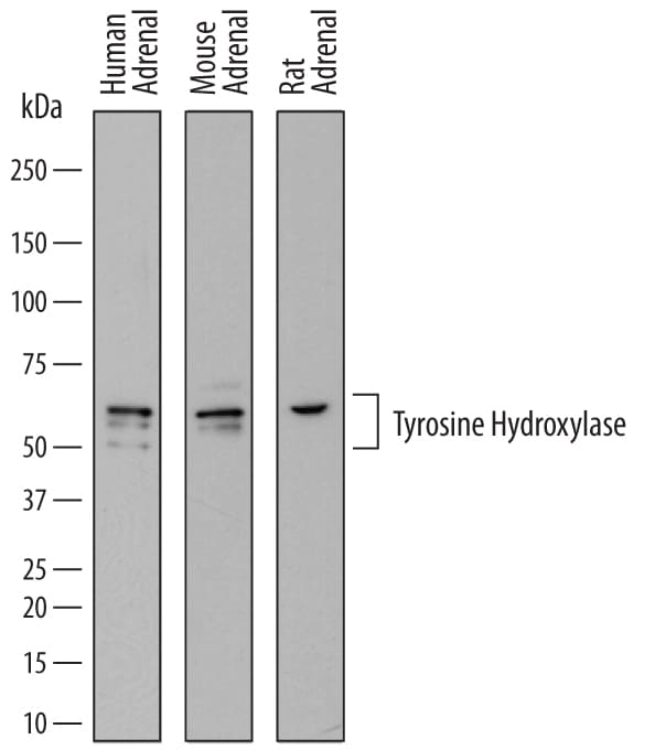 Detection of Human, Mouse, and Rat Tyrosine Hydroxylase antibody by Western Blot.