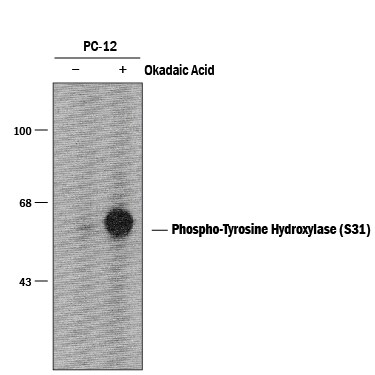 Detection of Phospho-Tyrosine Hydroxylase (S31) antibody by Western Blot