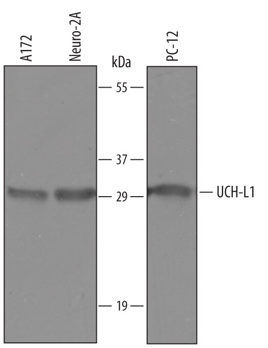 Detection of Human, Mouse, and Rat UCH-L1/PGP9.5 antibody by Western Blot.