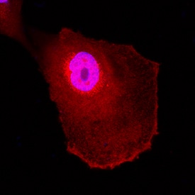 UCH-L1/PGP9 by Immunocytochemistry (ICC).5 antibody in A172 Human Cell Line by Immunocytochemistry (ICC).