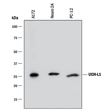 Detection of Human, Mouse, and Rat UCH-L1/PGP9.5 antibody by Western Blot.