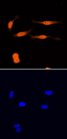 UFM1 antibody in HeLa Human Cell Line by Immunocytochemistry (ICC).