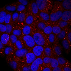 Glucuronosyltransferase 1A1/UGT1A1 antibody in HepG2 Human Cell Line by Immunocytochemistry (ICC).