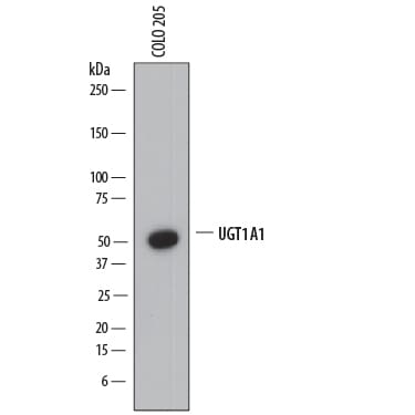 Detection of Human Glucuronosyltransferase 1A1/UGT1A1 antibody by Western Blot.