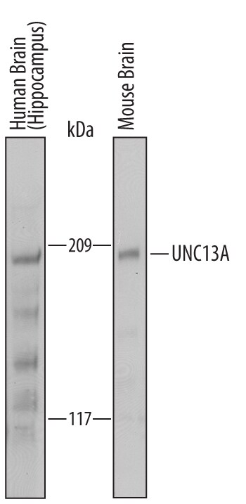 Detection of Human and Mouse UNC13A antibody by Western Blot.
