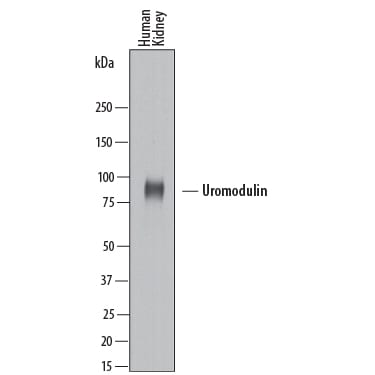 Detection of Human Uromodulin antibody by Western Blot.