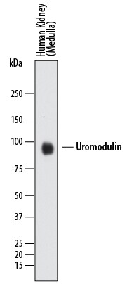 Detection of Human Uromodulin antibody by Western Blot.