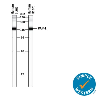 Detection of Human VAP-1/AOC3 antibody by Simple WesternTM.