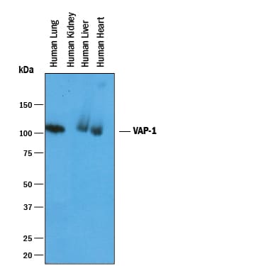 Detection of Human VAP‑1/AOC3 antibody by Western Blot.