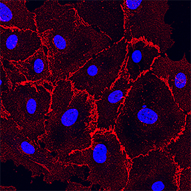 VE-Cadherin antibody in HUVEC Cells by Immunocytochemistry (ICC).