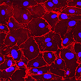 VE-Cadherin antibody in HUVEC Cells by Immunocytochemistry (ICC).