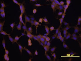 VEGF antibody in HUVEC Cells by Immunocytochemistry (ICC).