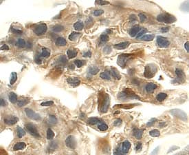 VEGF164in Rat Kidney.