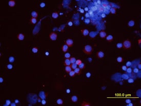VEGF antibody in Canine PBMCs by Immunocytochemistry (ICC).