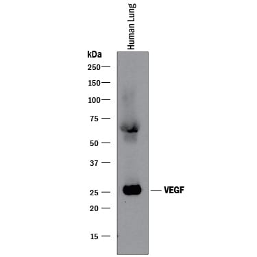 Detection of Human VEGF antibody by Western Blot.