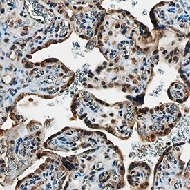 VEGF165bin Human Placenta by Immunohistochemistry (IHC-P).