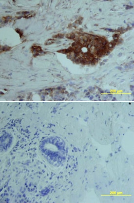 VEGFR1/Flt-1 antibody in Human Breast by Immunohistochemistry (IHC-P).