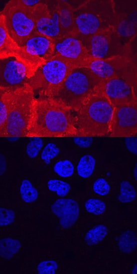 Phospho-VEGFR2/KDR/Flk-1 (Y1214) antibody in A431 Human Cell Line by Immunocytochemistry (ICC).