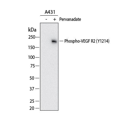 Detection of Human Phospho-VEGFR2/KDR/Flk-1 (Y1214) antibody by Western Blot.