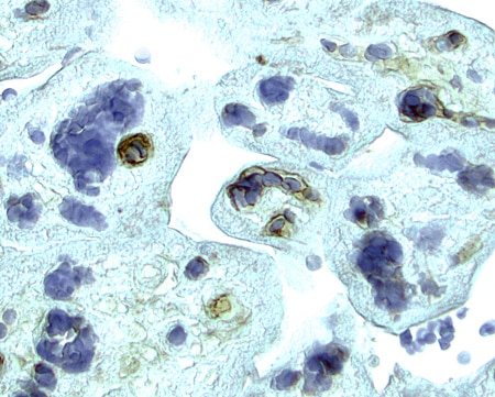 VEGFR2/KDR/Flk-1 antibody in Human Placenta by Immunohistochemistry (IHC-P).