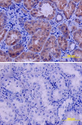 VEGFR2/KDR/Flk-1 antibody in Human Kidney by Immunohistochemistry (IHC-P).