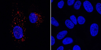 VEGFR2/KDR/Flk-1 antibody in HUVECs and Human HeLa Cell Line by Immunocytochemistry (ICC).