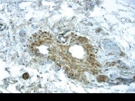 VEGFR2/KDR/Flk-1 antibody in Human Placenta by Immunohistochemistry (IHC-P).