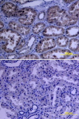 VEGFR2/KDR/Flk-1 antibody in Human Kidney by Immunohistochemistry (IHC-P).