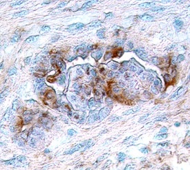 VEGFR3/Flt-4 antibody in Human Cervical Squamous Metaplasia by Immunohistochemistry (IHC-P).