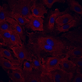 VEGFR3/Flt-4 antibody in HUVEC Human Cells by Immunocytochemistry (ICC).