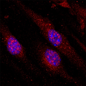 VG5Q antibody in bEnd by Immunocytochemistry (ICC).3 Mouse Cell Line by Immunocytochemistry (ICC).
