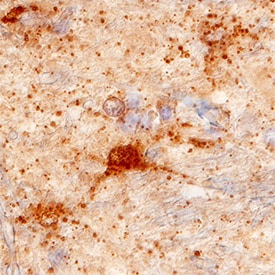 VGLUT1/SLC17A7 antibody in Human Brain by Immunohistochemistry (IHC-P).