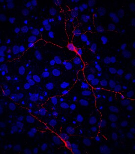 VIAAT/SLC32A1 antibody in Rat Cortical Stem Cells by Immunocytochemistry (ICC).