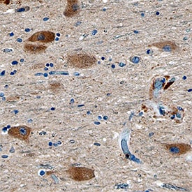 VMAT2 antibody in Human Brain by Immunohistochemistry (IHC-P).