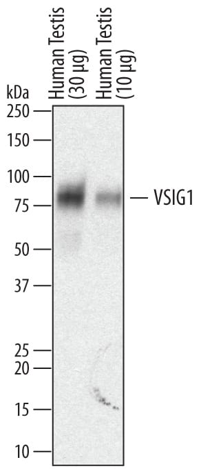 Detection of Human VSIG1 antibody by Western Blot.