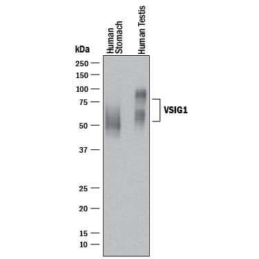 Detection of Human VSIG1 antibody by Western Blot.
