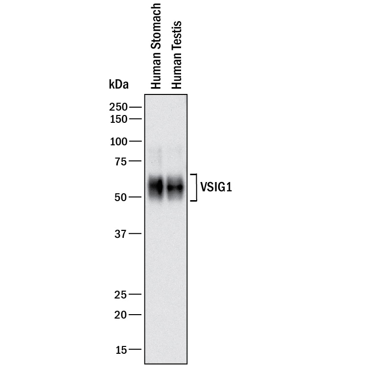Detection of Human VSIG1 antibody by Western Blot.