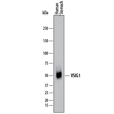 Detection of Human VSIG1 antibody by Western Blot.