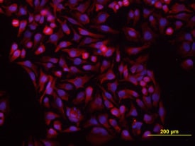 Vang-like Protein 1/VANGL1 antibody in HeLa Human Cell Line by Immunocytochemistry (ICC).