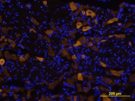 Vanilloid R1/TRPV1 antibody in Rat Brain by Immunohistochemistry (IHC-Fr).